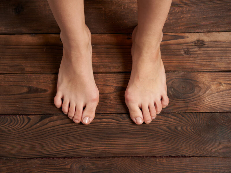 ripra-milano-riflessologia-plantare-alluce-valgo-metodo-ripra